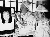 Walter Freeman, and the Lobotomy