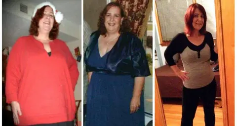 Episode 57 Weighing Over 400 Pounds, The Heart Attack That Saved Her Life