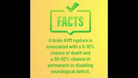 Brain AVM: Arteriovenous Malformation Fact