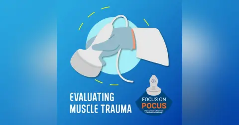 Evaluating Muscle Trauma: POCUS as First Line Imaging