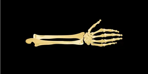 Carpal Tunnel Syndrome