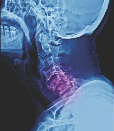 Episode 62 - Cervical Spine Injuries- An Interview with Dr. Jara-Alamonte
