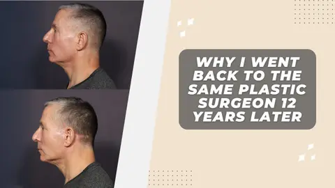 Patient Eric: Why I Came Back To the Same Plastic Surgeon Over 10 Years Later