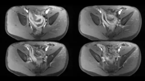 Episode 30: Body MRI