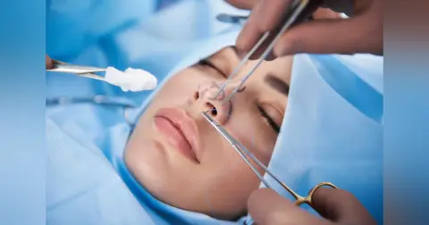 Rhinoplasty