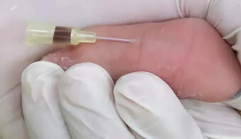 Pediatric Electrolyte Emergencies