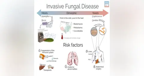#179 Invasive Fungal Disease: 5 Pearls Segment