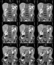 Episode 41 Body MRI Update