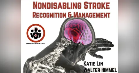 Ep 209 Nondisabling Stroke Recognition and Management