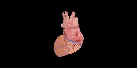 Truncus Arteriosus
