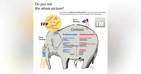 #128 Cirrhosis Bleeding Risk, FFP and Indwelling Pleural Catheters: Gray Matters Segments