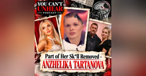 Glam Model Has Part of Skull Removed After Attack From Her Millionaire Boyfriend.. ANZHELIKA TARTANOVA