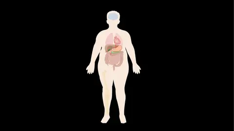 Introduction to Obesity