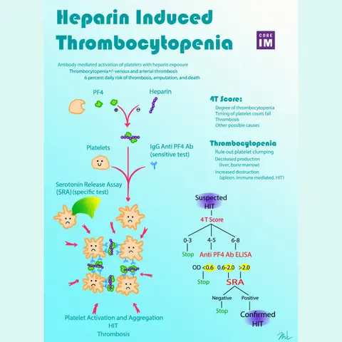 #53 Heparin-Induced Thrombocytopenia: 5 Pearls Segment
