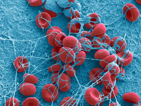 Episode 61 - Abnormal Uterine Bleeding