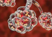 Episode 54 - Community-Acquired Pneumonia in the Emergency Department - Interview with  Matthew DeLaney, MD