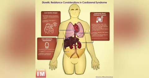 #158 Diuretics Resistance Cases