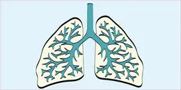 Solitary Pulmonary Nodule