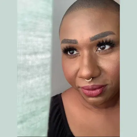 135. The Challenges of Managing Endo and Cancer as a Black Person. Part 2: Endo, with Lyssette Horne.