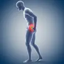 Renal Colic