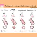 #149 Asthma Management and the MANDALA Trial: Beyond Journal Club with NEJM Group