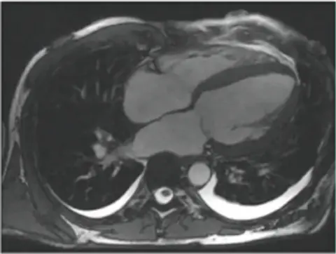 Episode 31: Cardiac MRI Update
