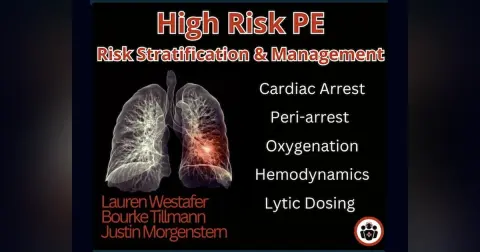 Ep 204 High Risk Pulmonary Embolism Management
