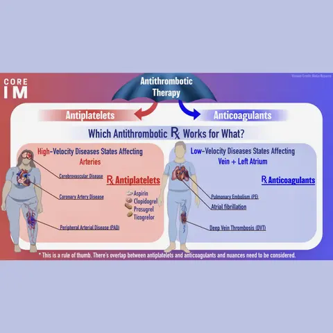 #85 Dual Antiplatelet Therapy: 5 Pearls Segment