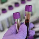 Conversation - High Sensitivity Troponin