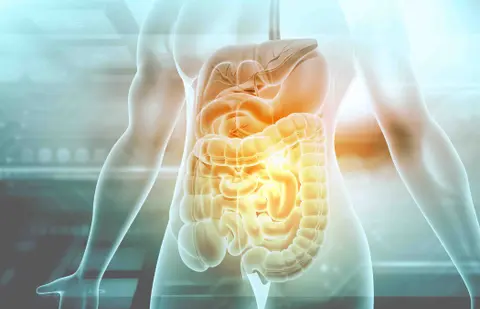 Gastrointestinal Stromal Tumors