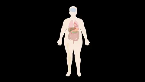 Flow of a Bariatric Patient