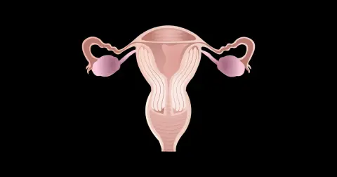 Endometrial Cancer Introduction