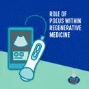 Role of POCUS within Regenerative Medicine