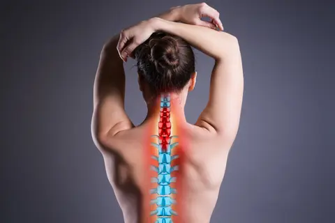 Degenerative Cervical Myelopathy