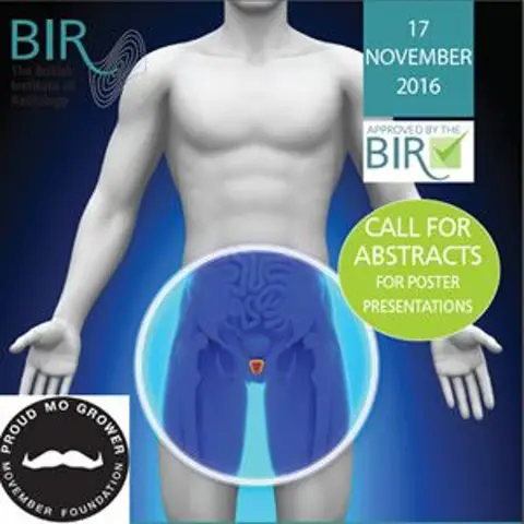 Prostate cancer commentary