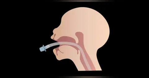 The Difficult Airway