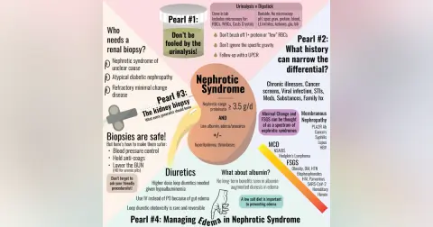 #74 Nephrotic Syndrome: 5 Pearls Segment