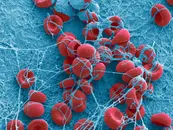 Episode 61 - Abnormal Uterine Bleeding