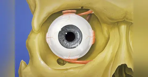 Thyroid-Associated Orbitopathy (Thyroid Eye Disease)