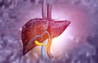Liver Series – Liver Cirrhosis