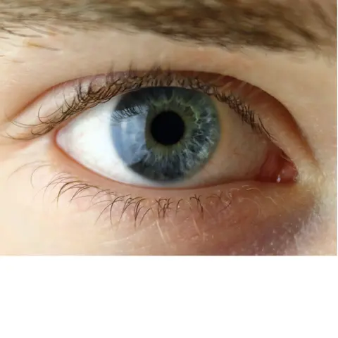 Eye Fundamentals