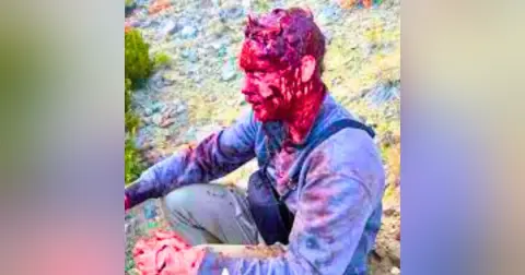 I was mauled by a bear and I fought it off. Ask Me Anything!