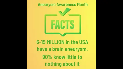Facts about Brain Aneurysm