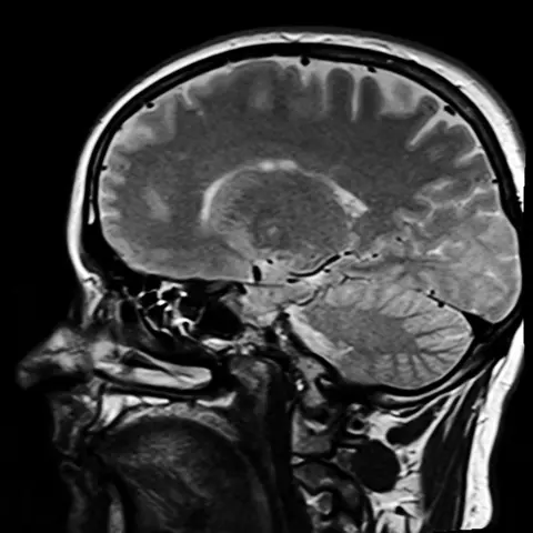 Brainwaves