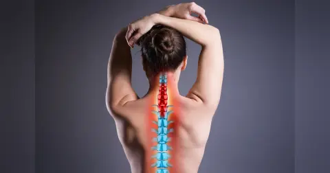Degenerative Cervical Myelopathy