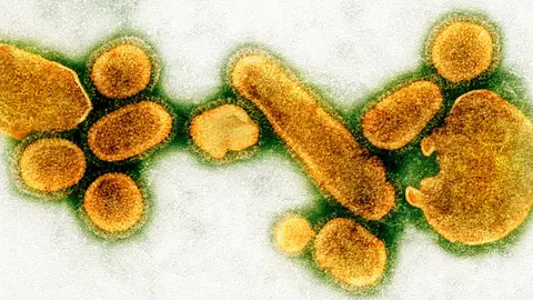 Why the world needs viruses to function