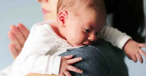 Laryngomalacia