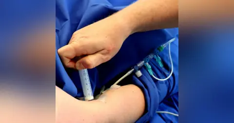 Procedural Sedation & Analgesia