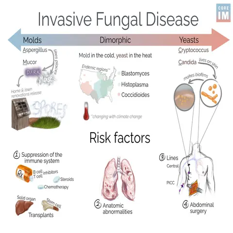 #179 Invasive Fungal Disease: 5 Pearls Segment