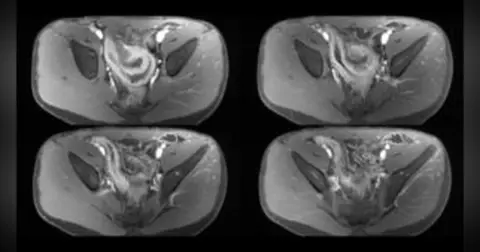 Episode 30: Body MRI